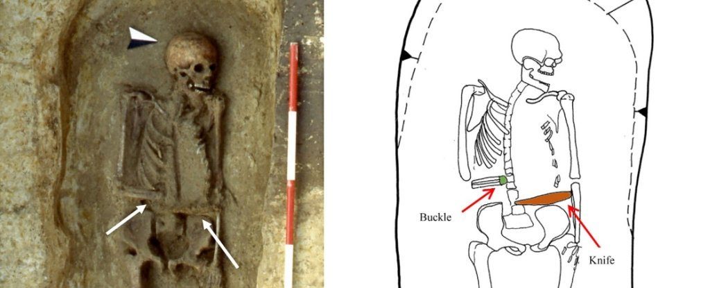 Общество: Нож вместо руки: в Италии нашли скелет со странным протезом